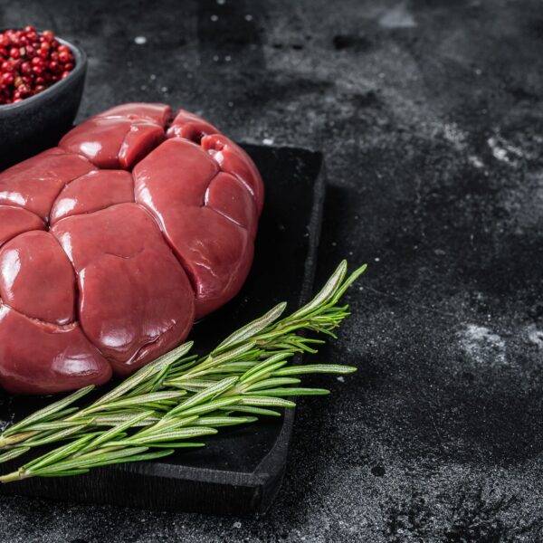 Kidney -2 count-